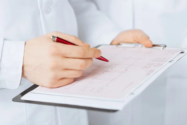 Mãos de médico masculino segurando cardiograma — Fotografia de Stock