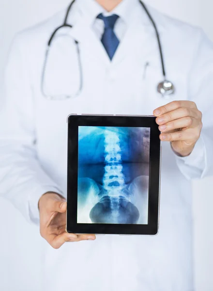 Médico varón sosteniendo la tableta pc con rayos X — Foto de Stock