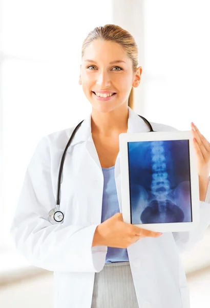 Médecin femme avec radiographie sur comprimé pc — Photo