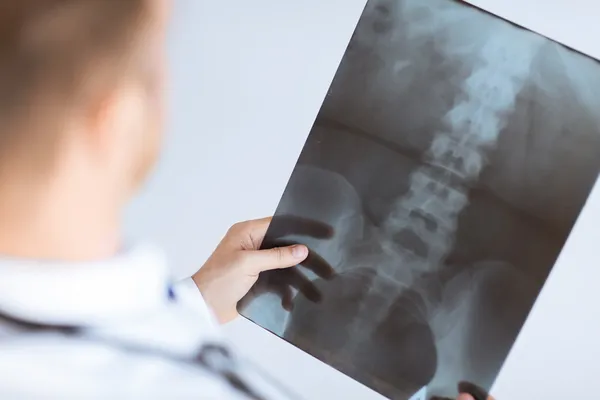 Médico segurando raio-x ou imagem roentgen — Fotografia de Stock