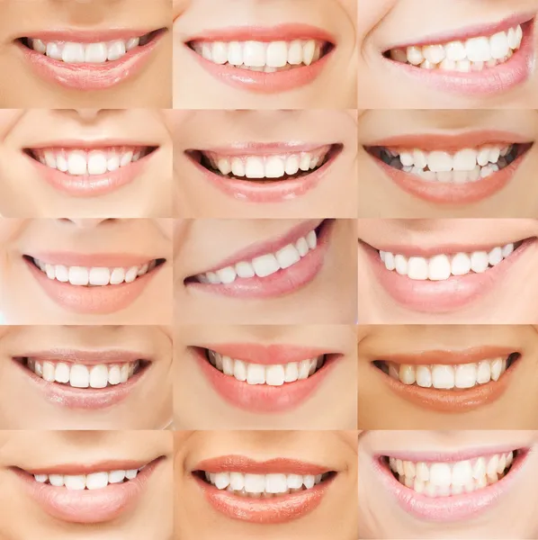 Examples of female smiles — Stock Photo, Image