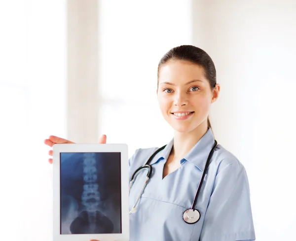 Female doctor with x-ray on tablet pc — Stock Photo, Image