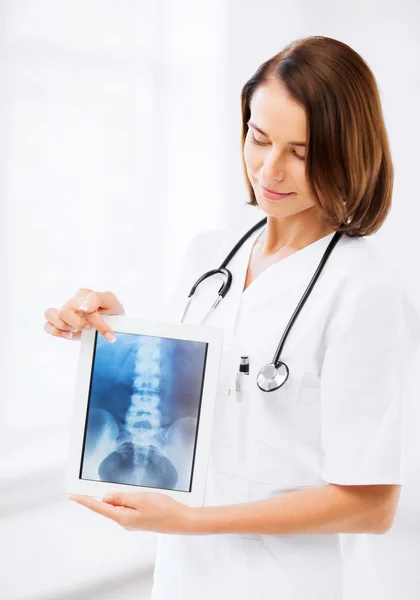 Vrouwelijke arts met x-ray op tablet pc — Stockfoto