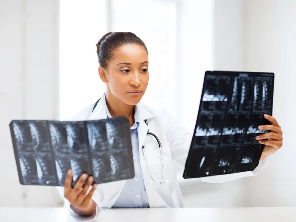 Afryki lekarz patrząc na zdjęcia rentgenowskie — Zdjęcie stockowe