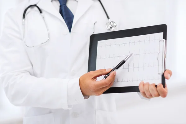 Male doctor hands holding cardiogram — Stock Photo, Image