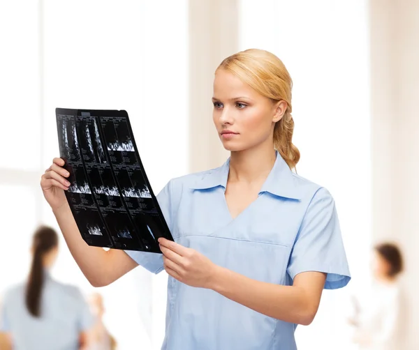 Médico ou enfermeiro sério a olhar para o raio-X — Fotografia de Stock