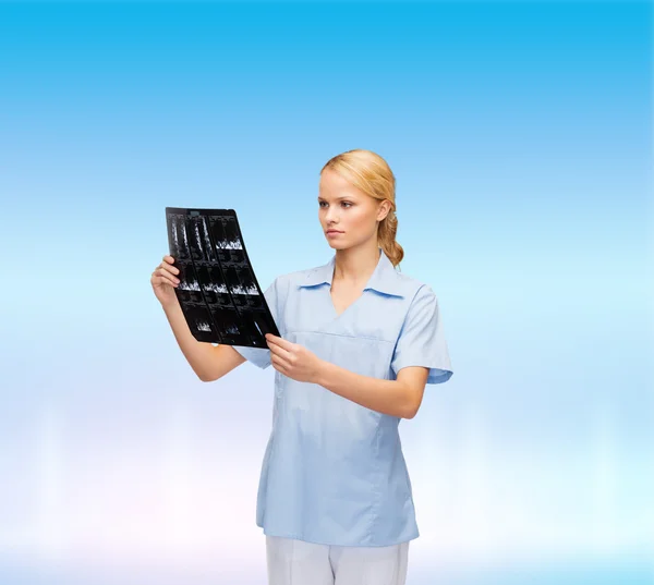 Serious doctor or nurse looking at x-ray — Stock Photo, Image