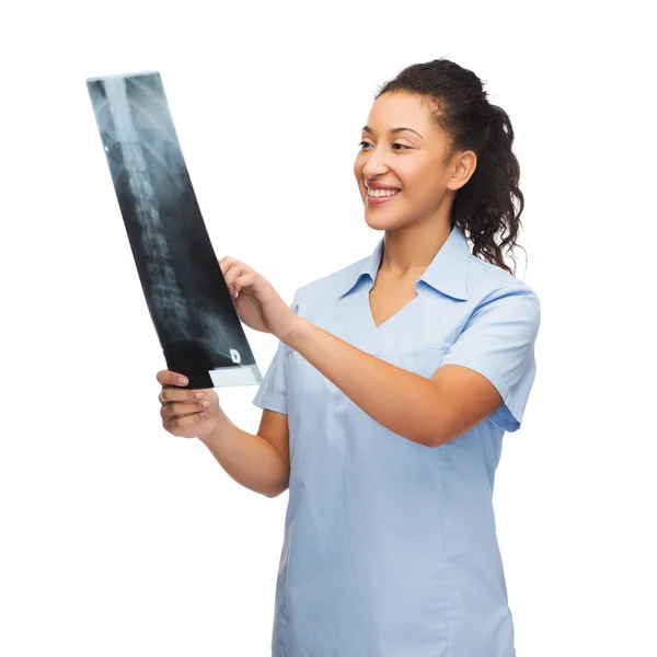 Sorridente medico femminile o infermiere guardando i raggi X — Foto Stock