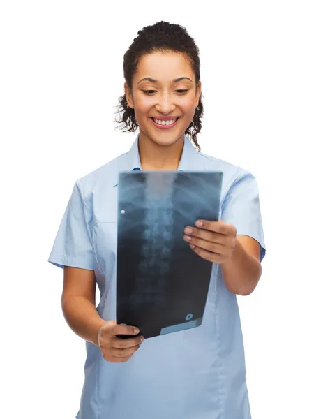 Médico o enfermera sonriente mirando rayos X — Foto de Stock