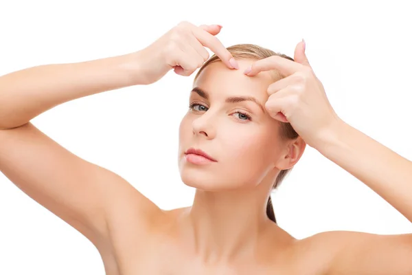 Young woman squeezing acne spots — Stock Photo, Image