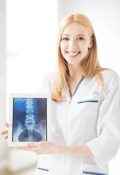 Médico femenino con rayos X en el comprimido pc — Foto de Stock