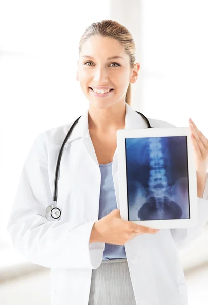 Жінка-лікар з рентгенівським знімком на планшетному ПК — стокове фото