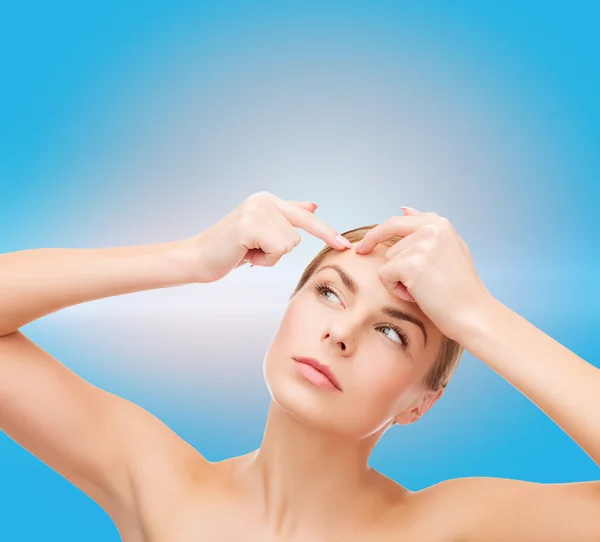 Jovem mulher apertando manchas de acne — Fotografia de Stock