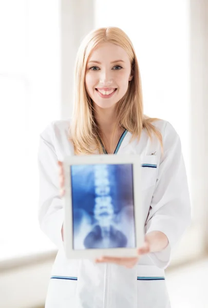 Médico femenino con rayos X en el comprimido pc — Foto de Stock