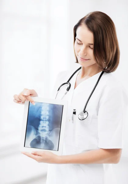 Médica com raio-x no tablet pc — Fotografia de Stock