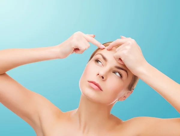 Jovem mulher apertando manchas de acne — Fotografia de Stock