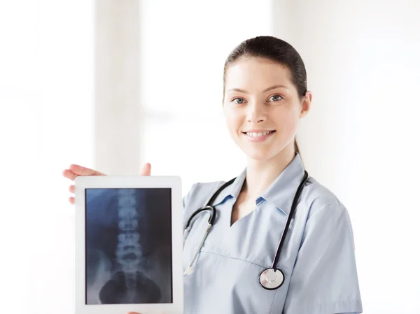 Ärztin mit Röntgenbild auf Tablet-PC — Stockfoto