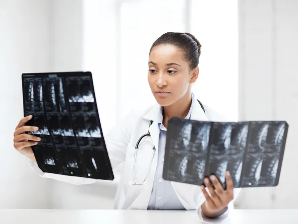 African doctor looking at x-rays — Stock Photo, Image