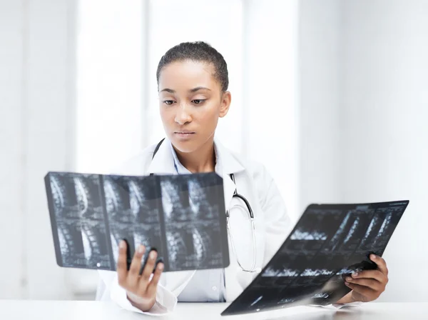 Médico africano mirando rayos X — Foto de Stock