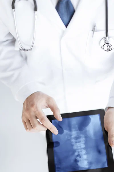 Médico masculino segurando tablet pc com raio-x — Fotografia de Stock