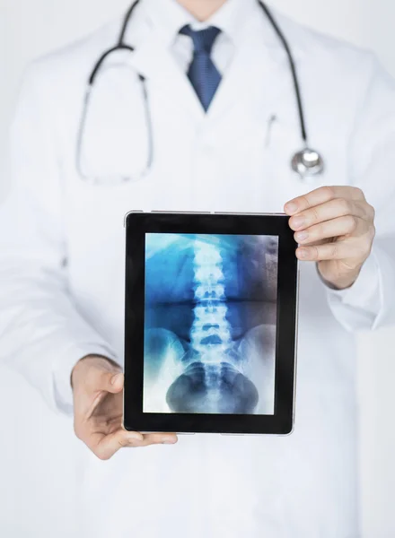 Врач-мужчина держит планшет с рентгеном — стоковое фото