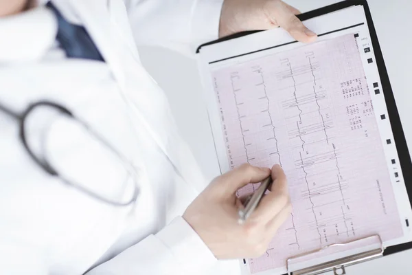 Manos de médico masculino con cardiograma — Foto de Stock