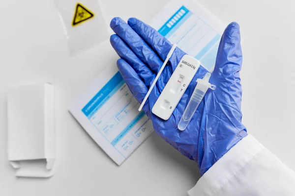 Nahaufnahme der Hand mit negativem Coronavirus-Test — Stockfoto