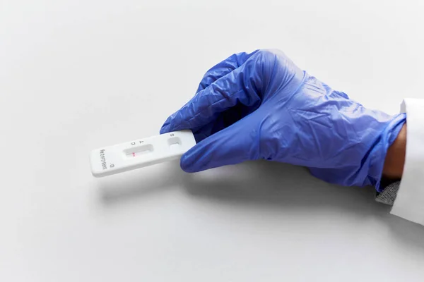 Крупним планом рука з негативним тестом на коронавірус — стокове фото