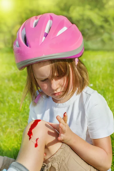 Roller skater with an injured leg — Stock Photo, Image