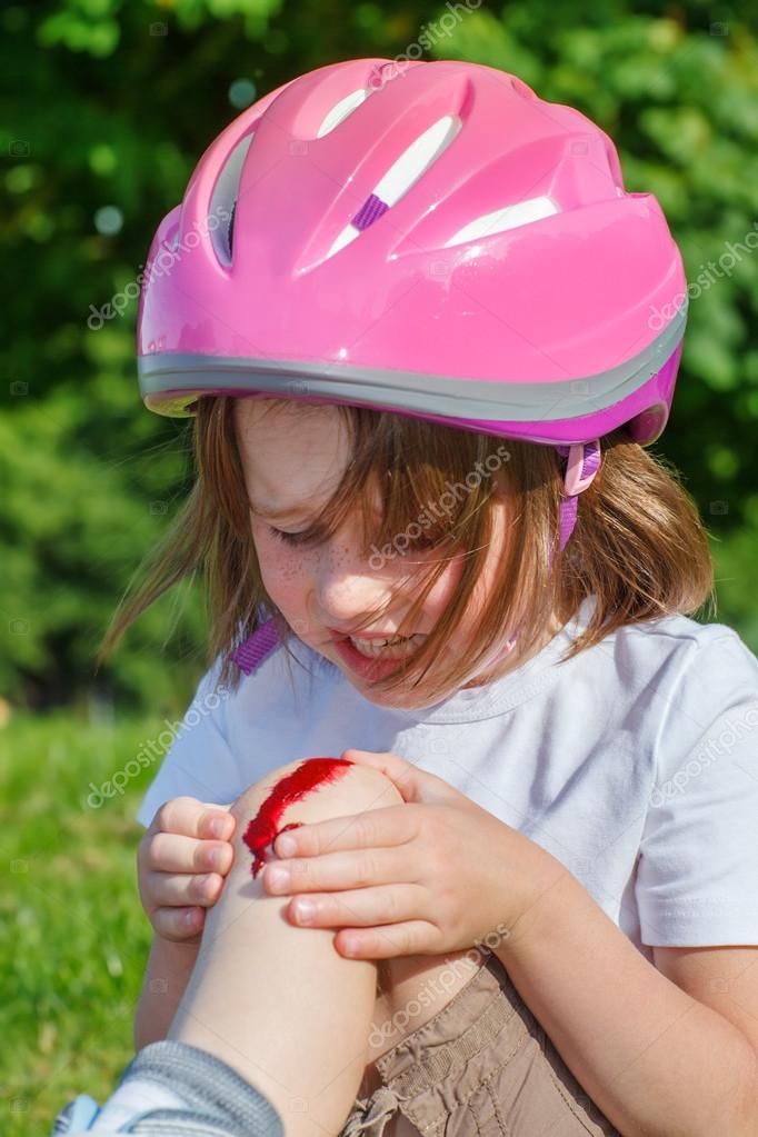 Bleeding knee Stock Photo by ©anatols 47541791