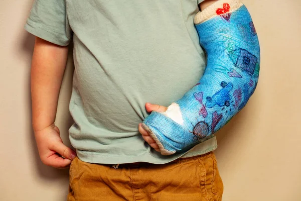 Close-up of a child broken hand in plaster cast after accident in kids drawings hearts, cars, sun