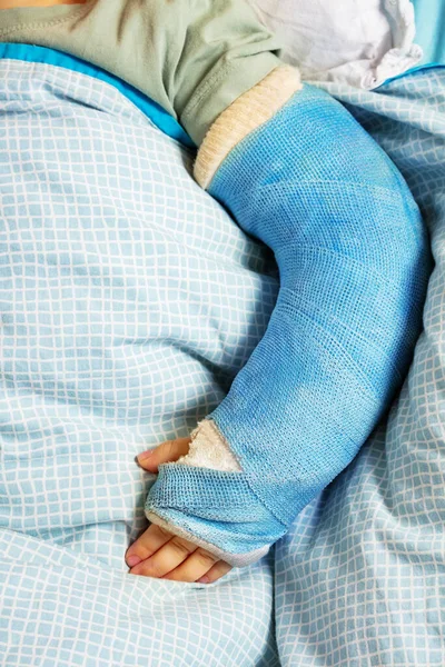 Close Little Boy Broken Hand Plaster Cast Lay Hospital Bed — ストック写真
