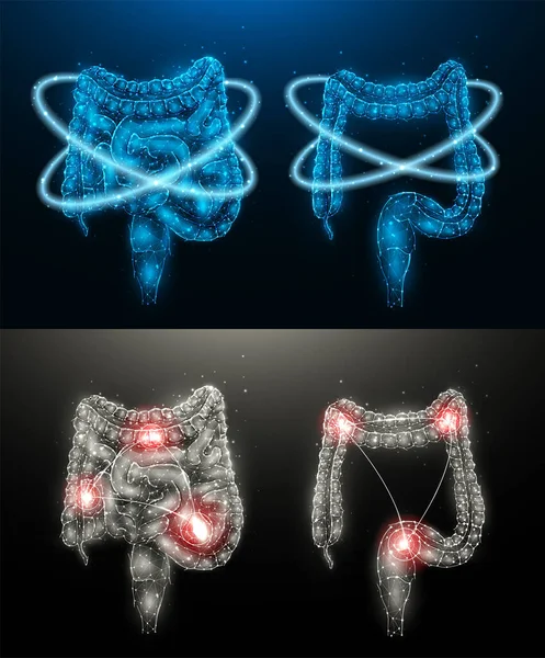 Ilustración Vectorial Poligonal Intestino Humano Inflamado Recuperación Función Intestinal Órganos — Vector de stock