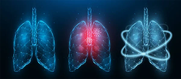Illustration Vectorielle Polygonale Poumons Humains Enflammés Poumons Sains Rétablissement Santé — Image vectorielle
