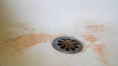 Old dirty bath top with hair close up