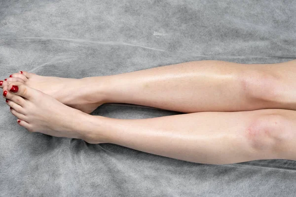 Image Concept Hair Removal Female Legs Beauty Salon — Foto Stock