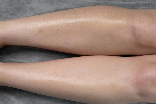 Image Concept Hair Removal Female Legs Beauty Salon Close — Photo