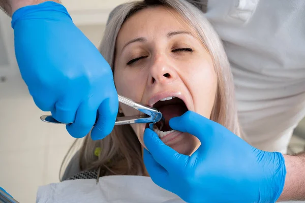Zbliżenie Ust Biednej Dziewczyny Śliniaczka Pacjenta Klinice Stomatologicznej Dentystka Niebieskich — Zdjęcie stockowe