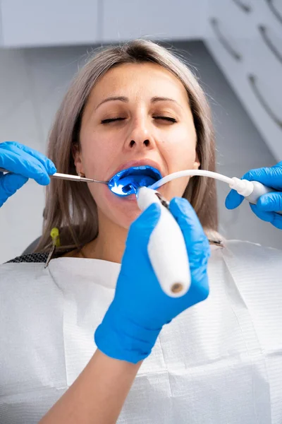 Dentystka Leczy Ubytek Zębów Niebieskich Rękawiczkach Leczenie Próchnicy Dentysty Gabinecie — Zdjęcie stockowe