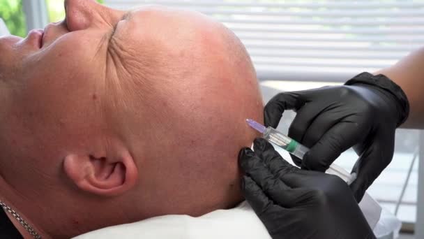Senior man with hair loss problem receiving injection in beauty salon, plešatý muž getting prp, detailní záběr — Stock video