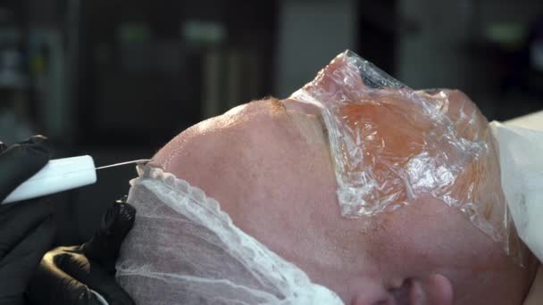 Ultraljudsskrubbning. man som får ultraljud kavitation peeling och ansiktsrengöring. ansiktsvård, ansiktsrengöring. Kosmetologi — Stockvideo