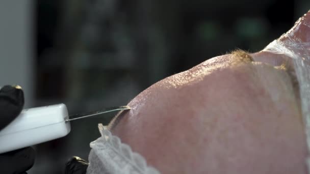 Ultrazvukové Kožní Vybavení Žena Čelí Kosmetické Léčbě Čistění Proti Akné — Stock video