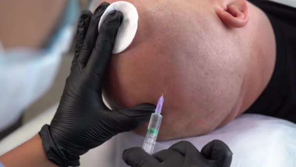 皮膚科医との間にメソセラピーの手順中に脱毛症と男性の頭の閉鎖 男性患者の頭部への注射Psp バランスと専門的な治療の概念 — ストック動画