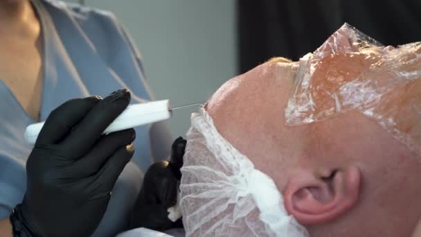 Läkare Med Ultraljud Scabber Procedur För Ultraljudsrengöring Ansiktet Man Skönhetskliniken — Stockvideo
