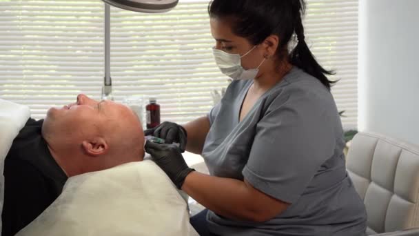 Arzt Ästhetiker Medizinischen Handschuhen Macht Hyaluronsäure Verjüngung Schönheitsinjektionen Glatze Kopf — Stockvideo