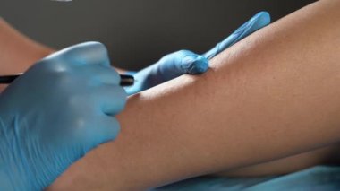 Elektroepilasyon cihazı ve cımbız kullanarak istenmeyen kılların kalıcı olarak alınması. Elektroepilasyon işlemi profesyonel saç temizleme prosedürü