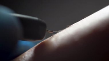 Elektro epilasyon kullanan bir kadında kılların kalıcı olarak alınması. Makro elektroliz, kapat. 4K video