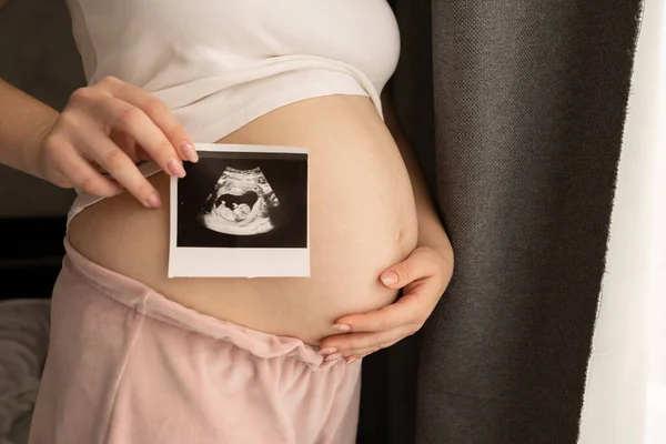 Pregnant Woman Ultrasound Image Medical Supervision Pregnancy Pregnancy Childbirth Concept — Fotografia de Stock