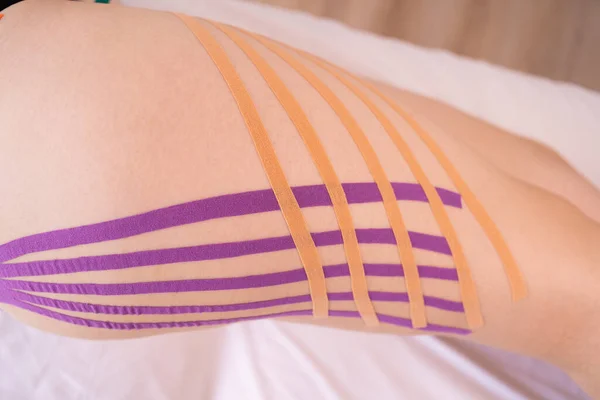 Applying Kinesiology Tape Patient Legs Kinesiology Taping Cellulite Procedure Slim — стоковое фото