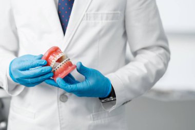Closeup of doctor male hands in gloves holding prosthetic human jaws with metal braces. Visit to dentist, orthodontist concept.